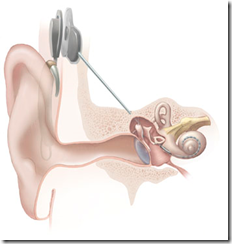 earCochlear01