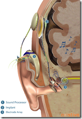 earCochlear04